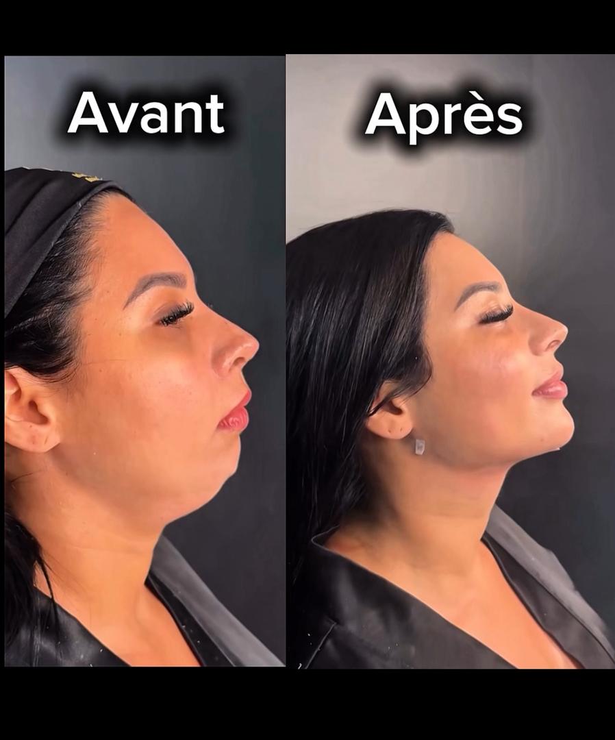 ✨ Masque Lifting V-Line – Redessinez votre visage naturellement