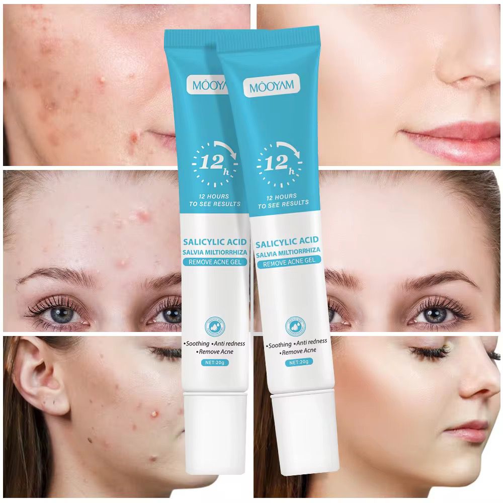 ✨ Gel Anti-Acné à l’Acide Salicylique – Retrouve une peau plus nette