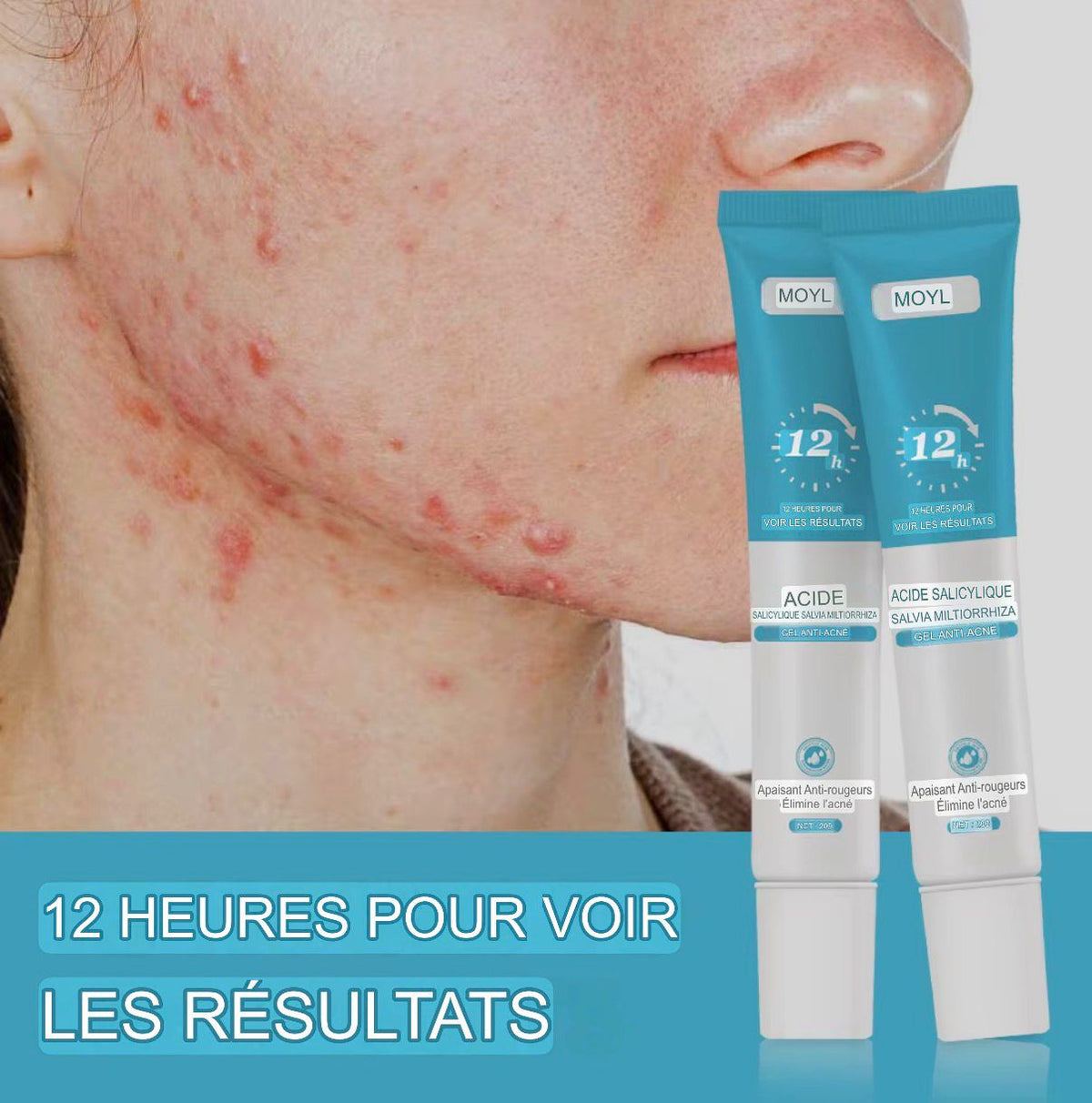 🌿 DUO CENTELLA + MOOYAM : LA ROUTINE PEAU NETTE & Éclatante ✨