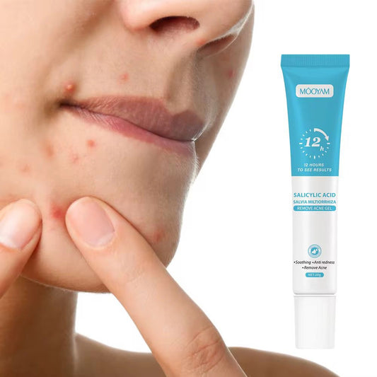 ✨ Gel Anti-Acné à l’Acide Salicylique – Retrouve une peau plus nette